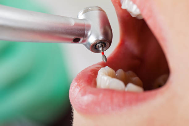Best Emergency Treatment for Toothache in Purcellville, VA